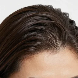 Dandruff shampoo 3x more effective for hair loss