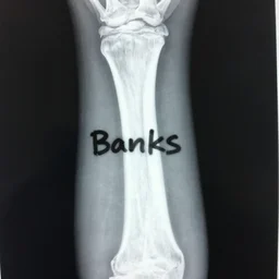 an xray of a humerous with 'Banksy' graffiti on the bone