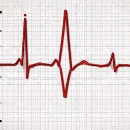 ecg of atril fibrillation, highly detailed, full hd