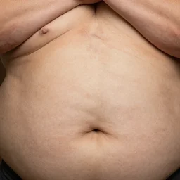 an abstract photograph of voluminous rolls of flesh, folds of belly flab, skin, veins, scabs, warts, acne, highly detailed, close up, even lighting