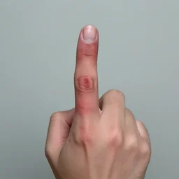 broken finger, trauma photography, sickening - n 4