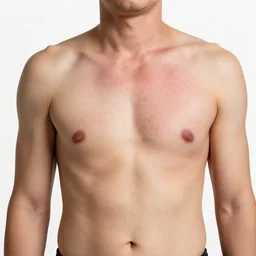a human infected with erythroderma, medical pictures in color showing their symptoms