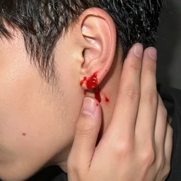 help im bleeding