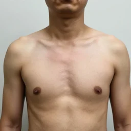a man with a large lump in the middle of his chest