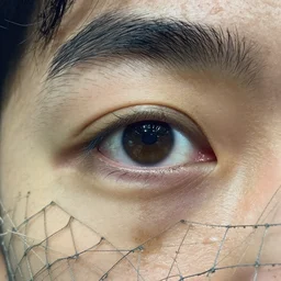 someone's eye getting stuck in a net