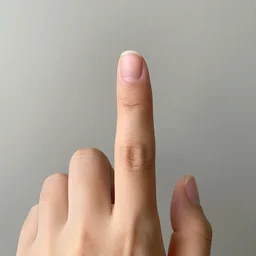 a hand that has one extra finger