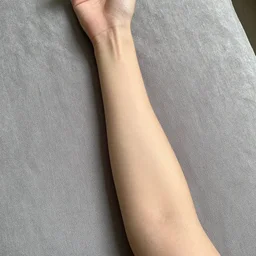 is my arm on properly?