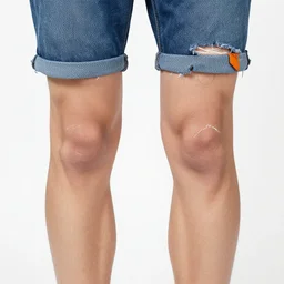 broken knees